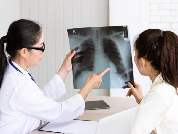 Uma Nova Esperança no Tratamento de Fibrose Pulmonar com Esbriet